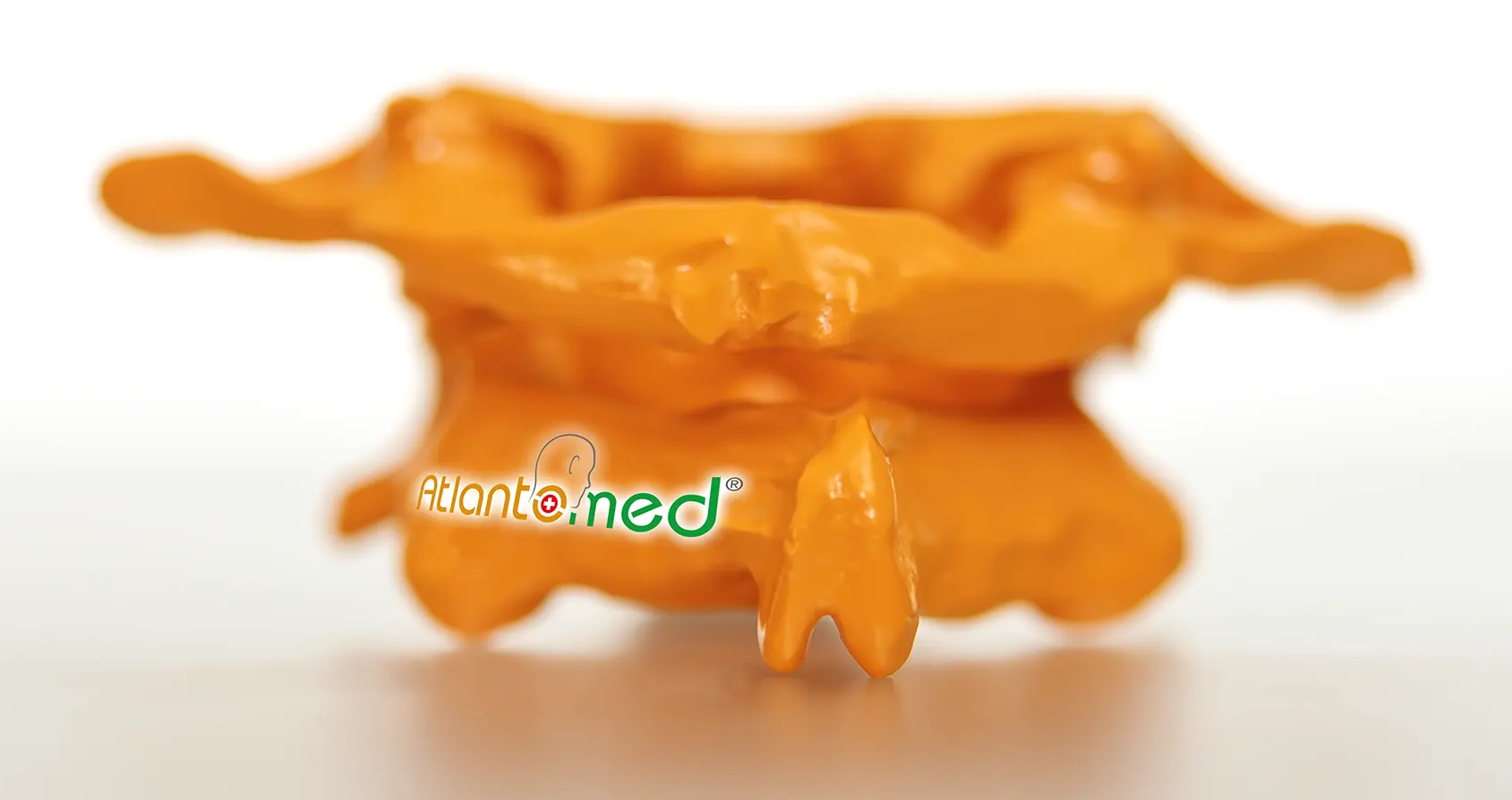 Vertebra Atlante su Epistrofeo